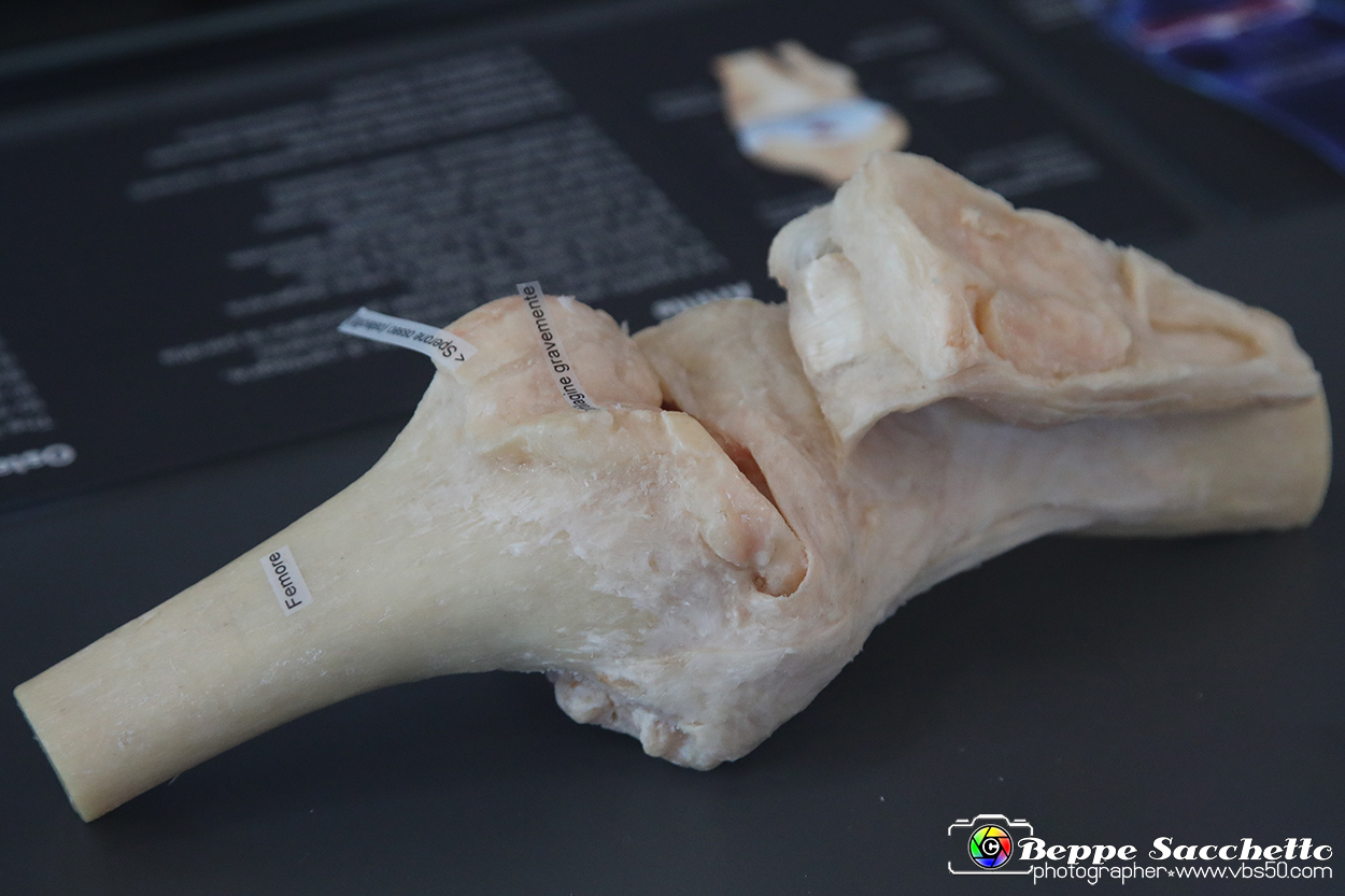 VBS_3068 - Artrite - Mostra Body Worlds.jpg